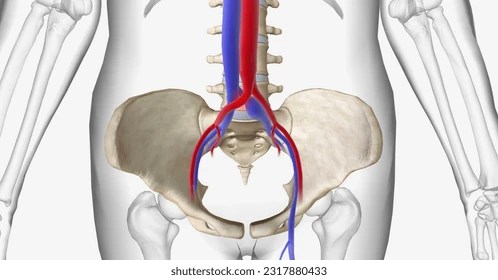 Síndrome de May-Thurner pode causar complicações graves, alerta&nbsp;médico